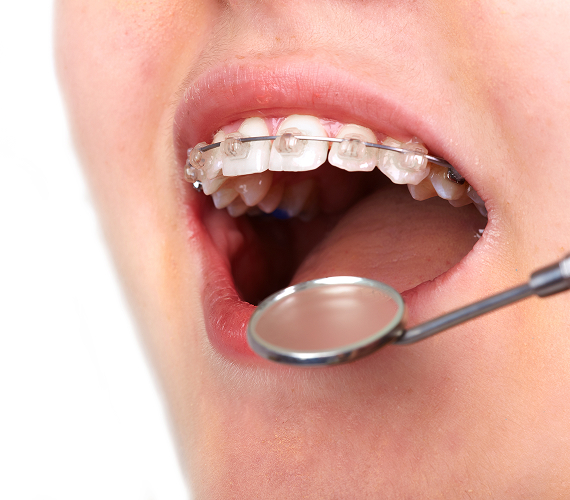 矯正歯科・小児矯正歯科