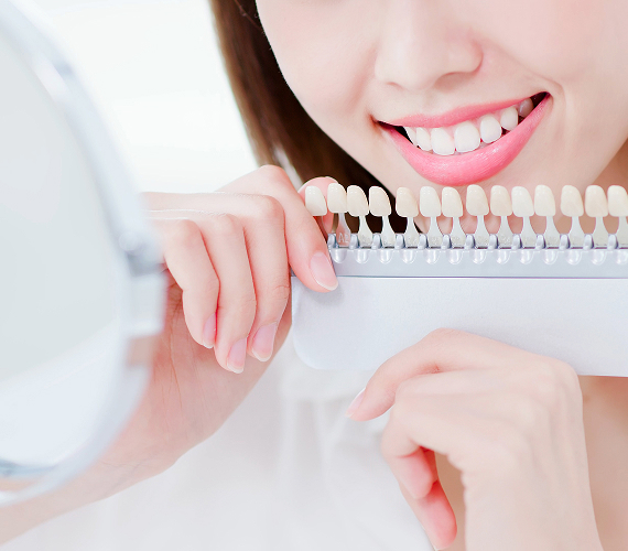 ホワイトニング