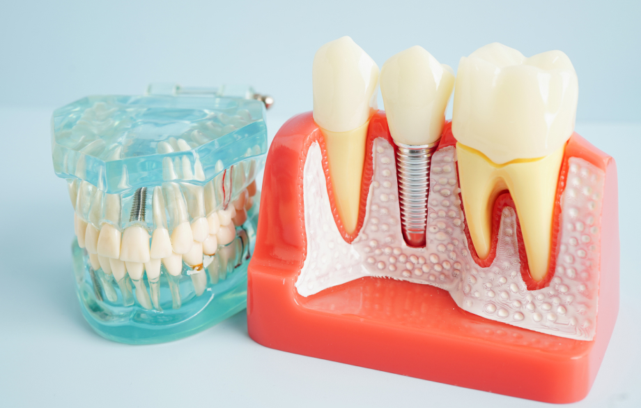 歯科口腔外科の高い専門性